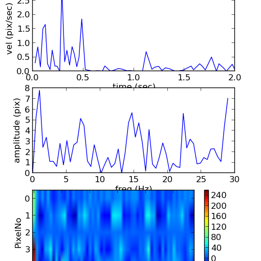 Further Development of Video Based Seizure Detector